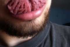 Trypophobic Tongue