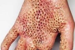 Trypophobic Hand