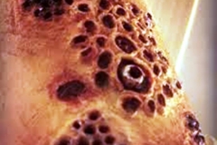 Trypophobic Skin