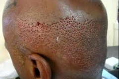 Trypophobic Head