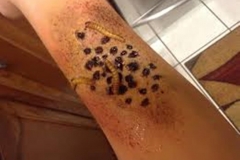 Trypophobic Worms