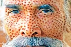 Trypophobic Old Man