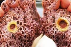 Disgusting Trypophobic Foot