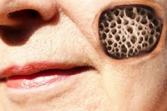 Trypophobic Face Wound