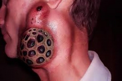 Trypophobic Neck Growth