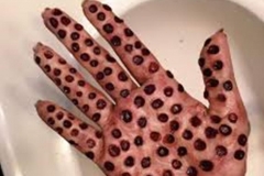 Trypophobic Hand