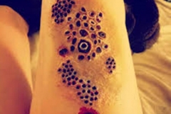 Trypophobic Holes