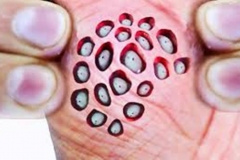 Trypophobic Lotus Pod Hand