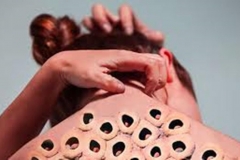 Trypophobic Back