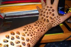 Trypophobic Skin