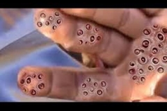 Trypophobic Lotus Hand