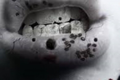 Trypophobic Mouth