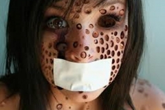 Trypophobic Woman