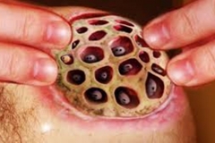 Trypophobic Lotus Wound
