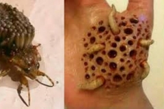 Trypophobia Worms