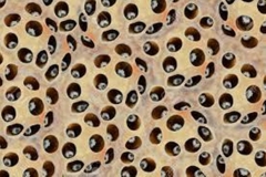 Trypophobia Pods