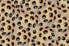 Trypophobia Pods