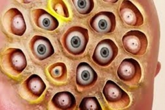 Dried Trypophobic Lotus Pod 3