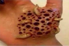 Burrowing Trypophobic Worms