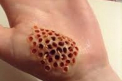 Trypophobic Worms