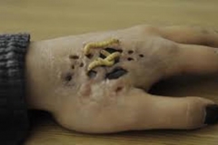Trypophobic Parasites