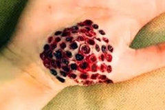 Oozing Trypophobic Hand