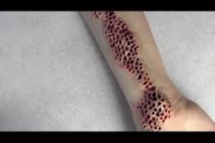 Trypophobic Arm
