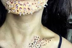 Trypophobic Infestation