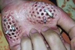 Trypophobic Maggots