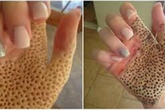 Trypophobic Palm 1